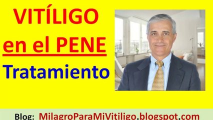 Vitiligo en el Pene tratamiento natural | Que son las Manchas Blancas de Vitíligo en el Pene glande prepucio tronco