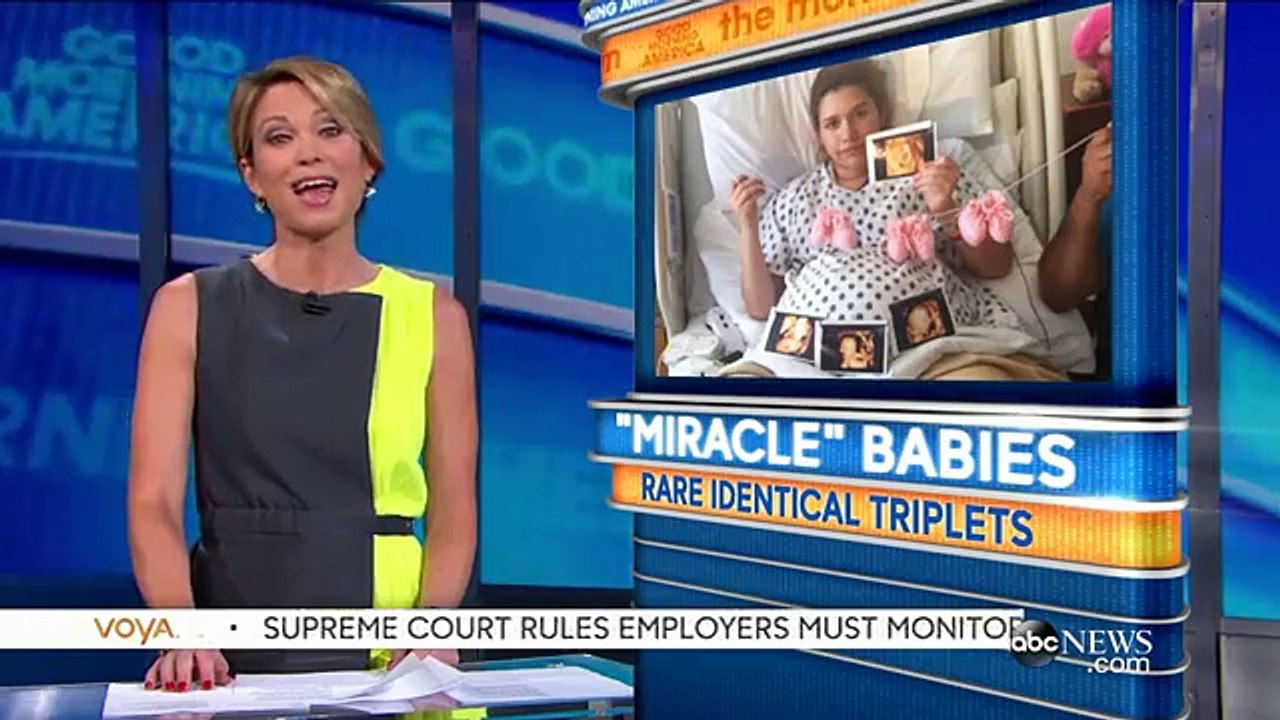 Conjoined Twins Born from Set of Identical Triplets