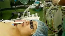ﾗﾘﾝｼﾞｱﾙﾏｽｸ ﾗﾘﾝｹﾞﾙﾏｽｸ 挿入 LMA laryngealmaskairway proseal