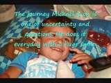 Neurofibromatosis Michael's Journey.wmv