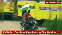 Hintli Adam, Omuzlarını Göğüs Kafesinde Birleştirebiliyor