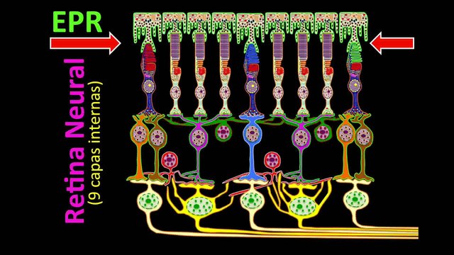 Desprendimiento de retina (moscas volantes, luces, cortina negra)