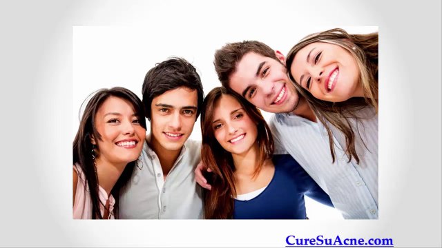 3 Remedios caseros para las espinillas en la cara