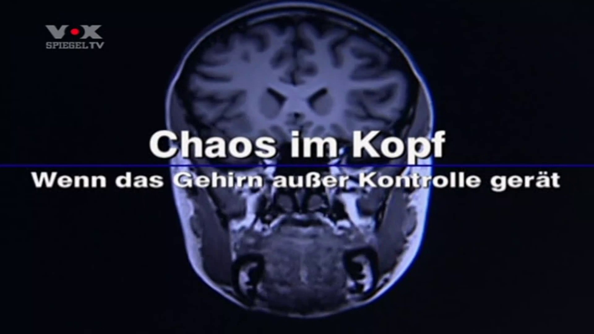 Chaos im Kopf 1v2 Wenn das Gehirn ausser Kontrolle gerät 2008 by ARTBLOOD Chaos im Kopf 1v2 Wenn das Gehirn ausser Kontrolle gerät 2008 by ARTBLOOD
