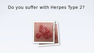 how to get rid of herpes
