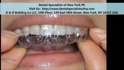 Dental Specialists of New York PC : New York City Invisalign
