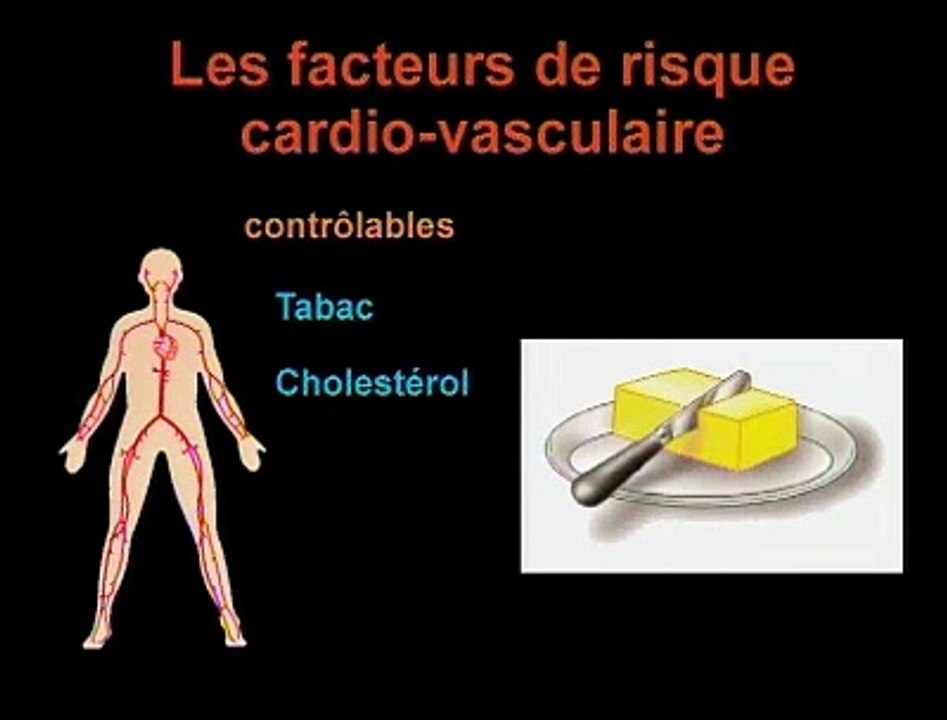 LES FACTEURS DE RISQUE CARDIO-VASCULAIRES