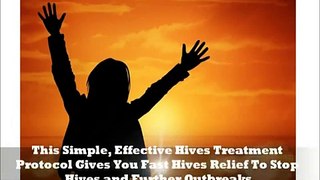 Get Rid Of Hives Naturally - Cure Hives With This Natural Home Remedy