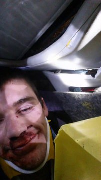 This guy filmed his own car crash and firemen intervention!