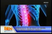 Bien Informado - Información sobre tumores en la columna vertebral