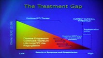 New Options for Treating GERD – Beyond PPIs | David C. Chen, MD |  UCLA Digestive Disease