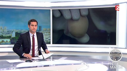 Une main bionique pour remplacer une main perdue