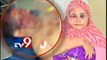 Aurangabad Robbers Attack,Couple Injured-TV9
