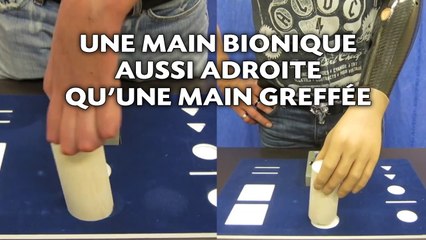 Une main bionique aussi adroite qu'une main greffée
