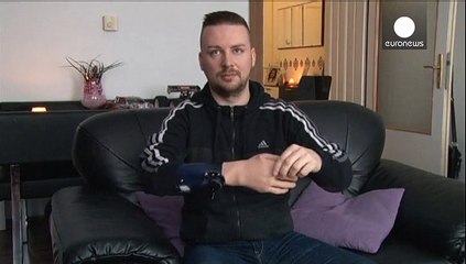 Austrian men become first in the world to have bionic hands