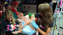 Etats-Unis : Une opération de 26 heures pour séparer des soeurs siamoises