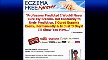 Eczema Treatment - Eczema Free Forever