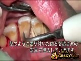 Ce japonais ne s'est pas lavé les dents pendant 10 ans