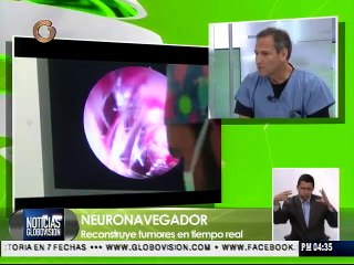 Neuronavegación ayuda a mejorar diagnosticos médicos