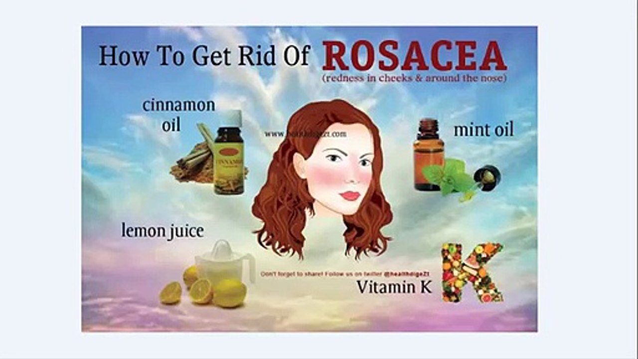 How to get rid of rosacea