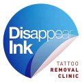 Fading a Tattoo for a Cover-up