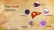 Liver- Treatment for severe liver diseases (Facts about liver diseases)