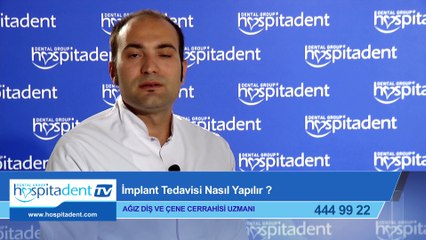 İmplant Tedavisi Nasıl Yapılır?