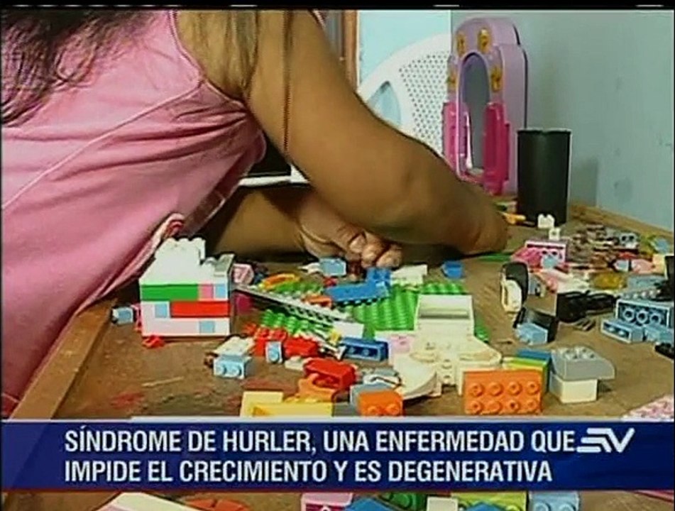 Dos hermanos ecuatorianos que luchan contra un extraño síndrome