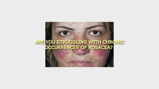 How To Heal Rosacea, Eczema, Acne, (And More), Naturally