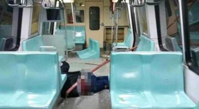 Kalçasına Demir Saplanan Güvenlikçi, Şikâyetçi Olmadı; İşi Kaptı