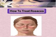 Treating Rosacea