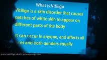 does natural vitiligo treatment system work - cure vitiligo fast