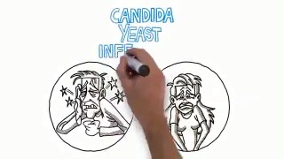 Yeast Infection No More, Free Candida Yeast Infect