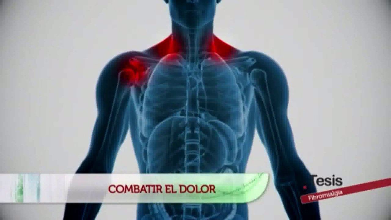 Fibromialgia