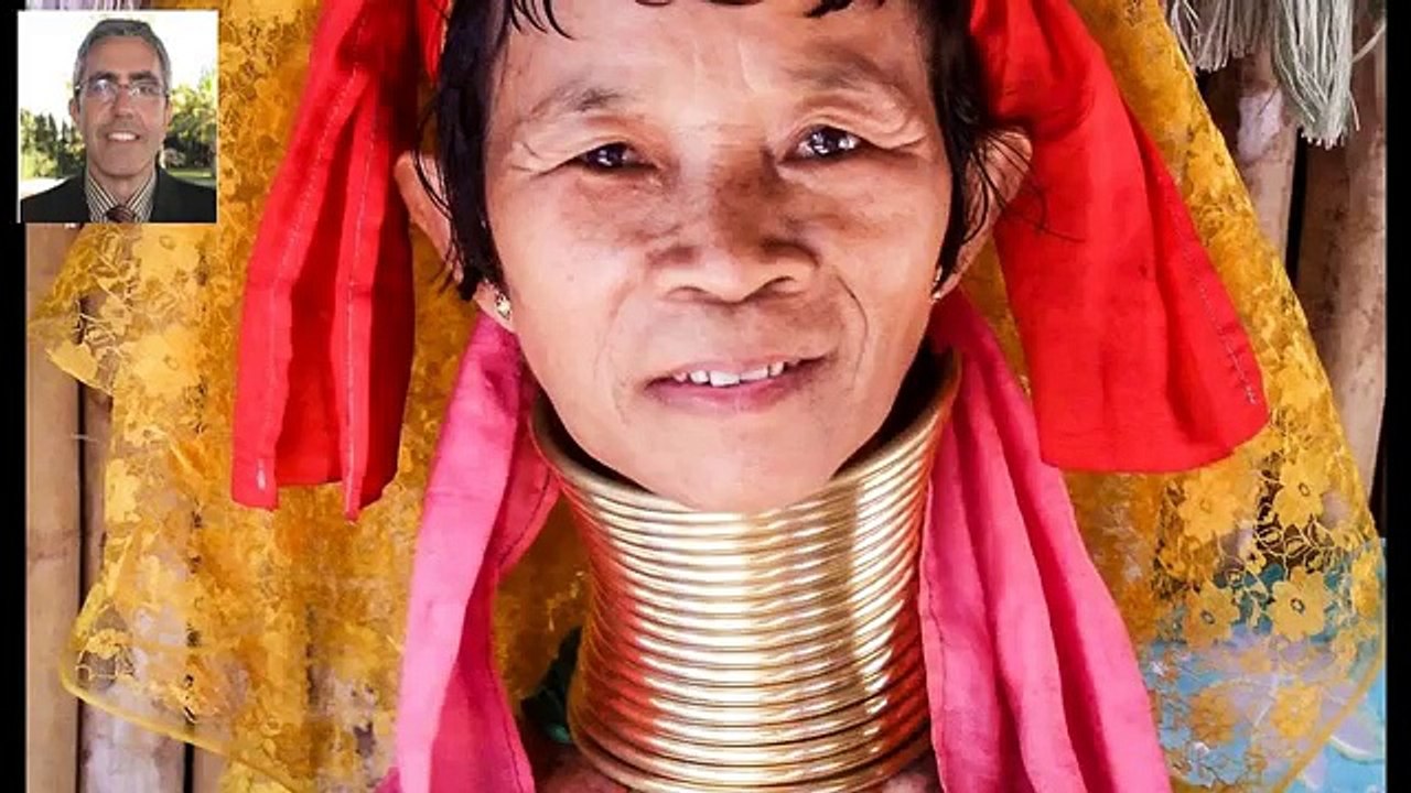 Cervicalgia, Dolor cervical. Causas síntomas tratamiento y remedios caseros Doctor Almendros