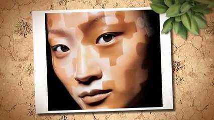 Vitiligo Prevention - Natural Vitiligo Treatment System