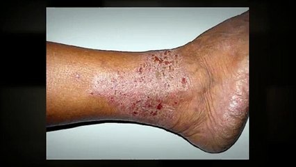 5 Most Common Skin Disorders