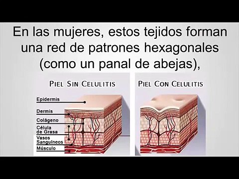 adios celulitis ¡Si! adiós celulitis