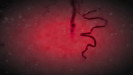 How Ebola attacks the body