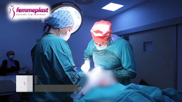 Karın germe ameliyatı sonrası iz kalır mı - Karın Germe Estetik