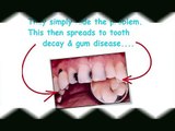 [NEW] Rapid Dental Remedies[NEW]