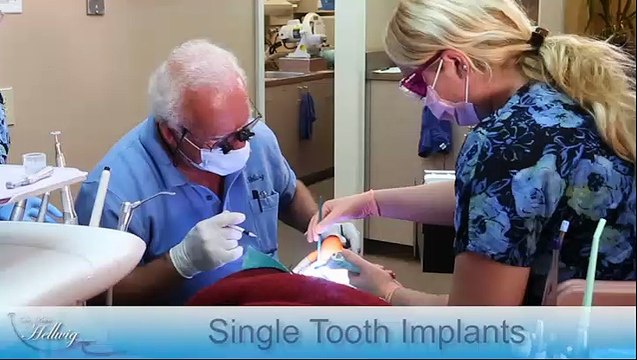 Single Tooth Implants - San Diego, CA - Dr. Peter Hellwig