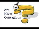 Are Hives Contagious