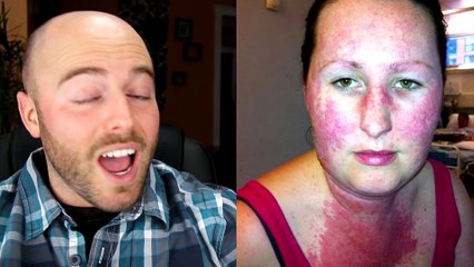 10 BIZARRE Diseases Science Can t Explain!