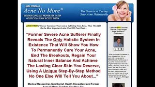Buy Acne No More Video Review