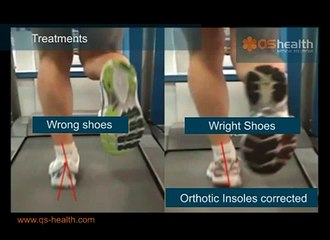 Heel Pain Plantar Fasciitis QS Health