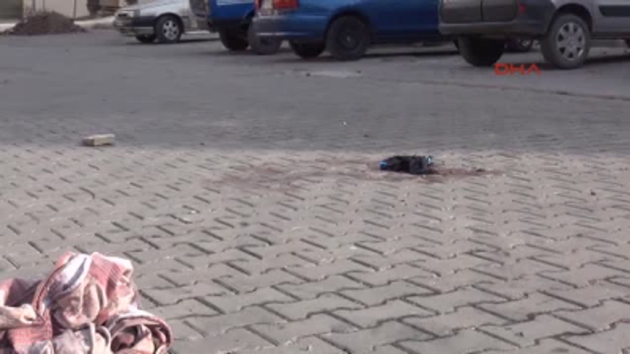 Boşandığı Eşini Sokak Ortasında Bacaklarından Vurdu