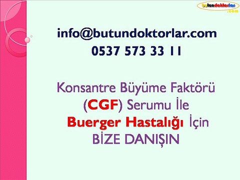 cgf serumu ile burger_hastaligi tedavisi,burger hastalığı resimleri,burger hastalığı belirtileri,burger hastalığı nasıl geçer,burger hastalığında kök hücre tedavisi, burger hastalığı tedavisi,burger hastalığı diyeti,burger hastalığı bitkisel tedavi,burger