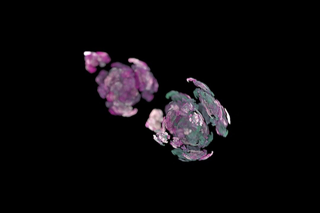 "Music for the Lungs" - healing meditation music for your Lungs & Bronchial tubes, Music Therapy