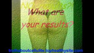 The Truth About Cellulite Ebook